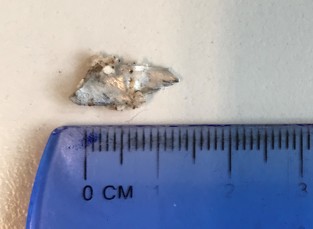 Piece of metal from Krispy Kreme doughnut